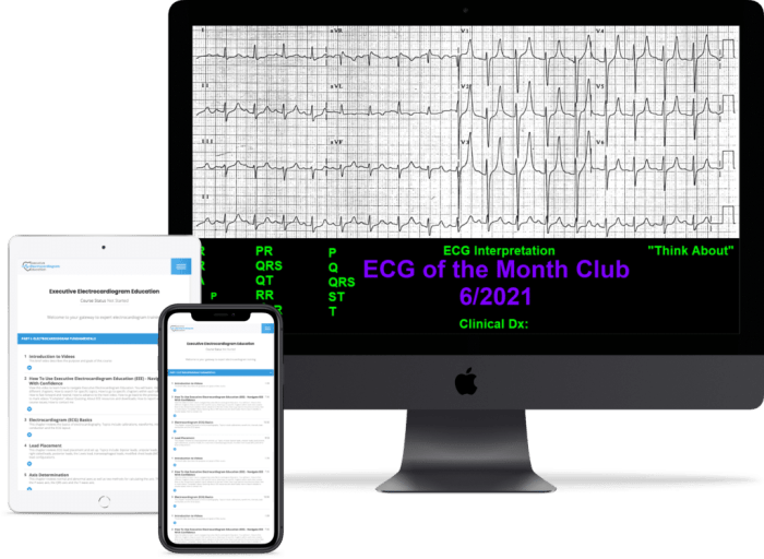 Apex innovations ecg test answers