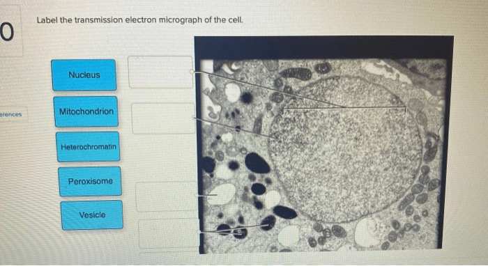 Provide the labels for the electron micrograph in figure 19.5