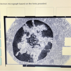 Provide the labels for the electron micrograph in figure 19.5