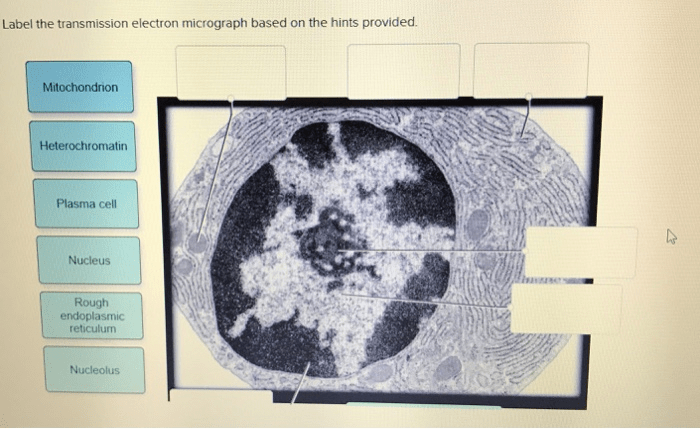 Provide the labels for the electron micrograph in figure 19.5