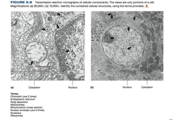 Electron micrograph nucleus